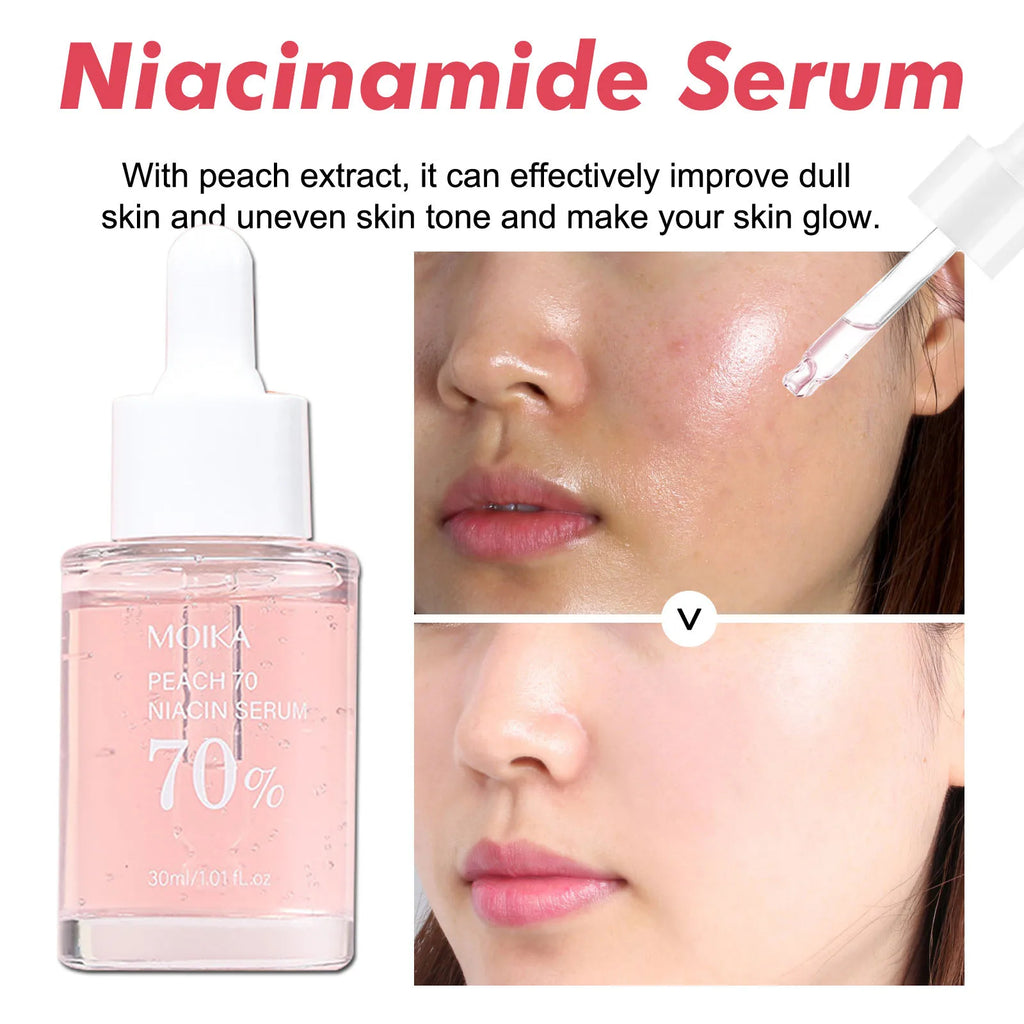 Niacinamide dark spot remover serum fade acne marks and brighten skin